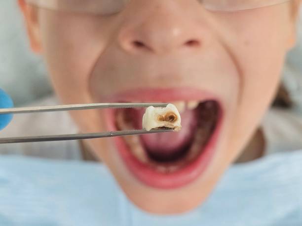 Best Broken or Cracked Tooth Emergency Dentist in Avis, PA